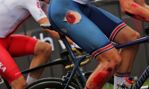 Prevent injury and illness for cyclists. Injured cyclist on a bike